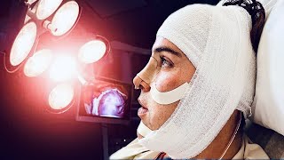 My Transgender Partner Had Facial Feminization Surgery   Why We Did It