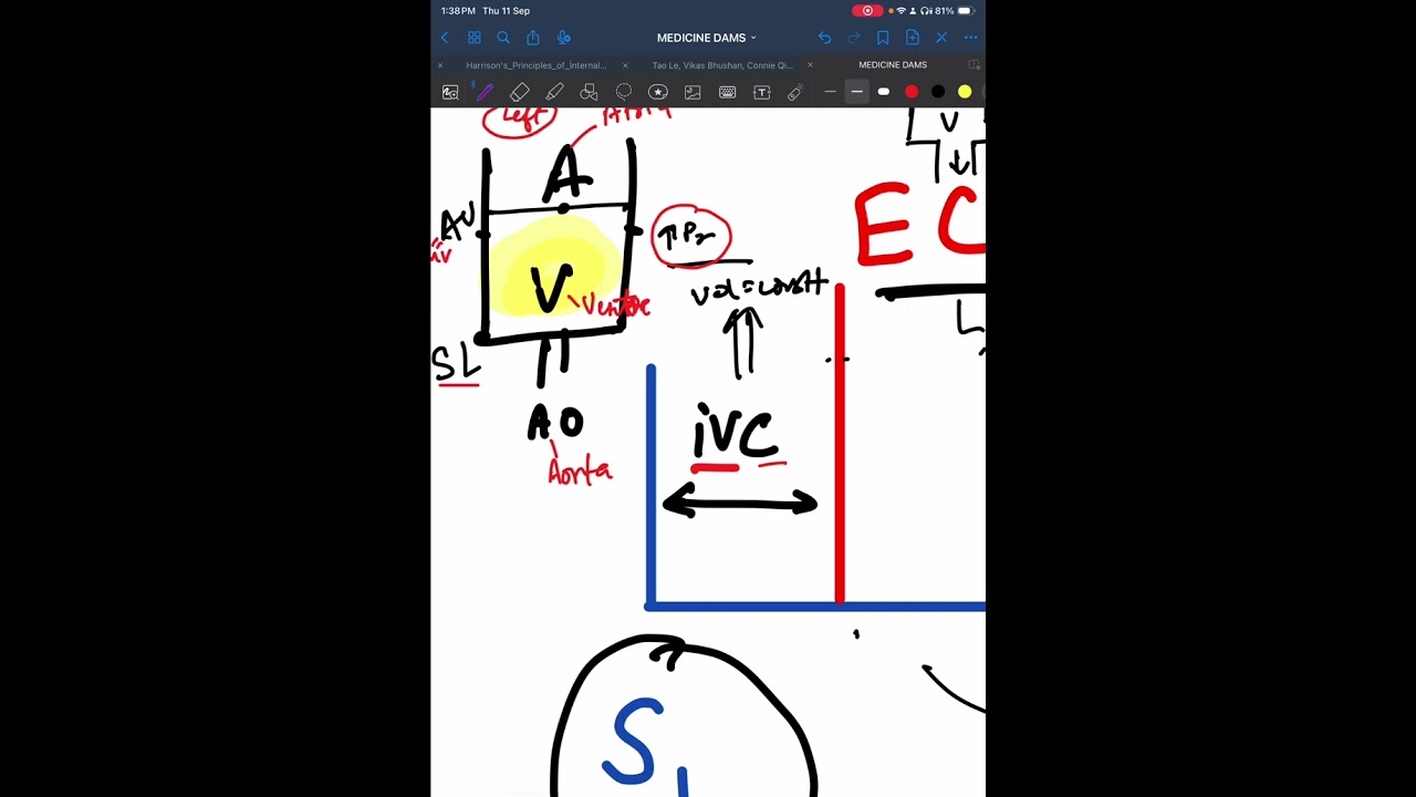 Simplified : Heart cycle and Heart Sounds. NEET PG/INICET/ FMGE/ MBBS