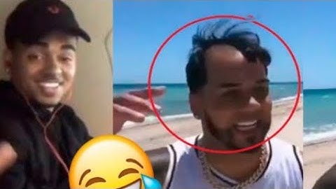 Anuel AA deja ver su calva  por error
