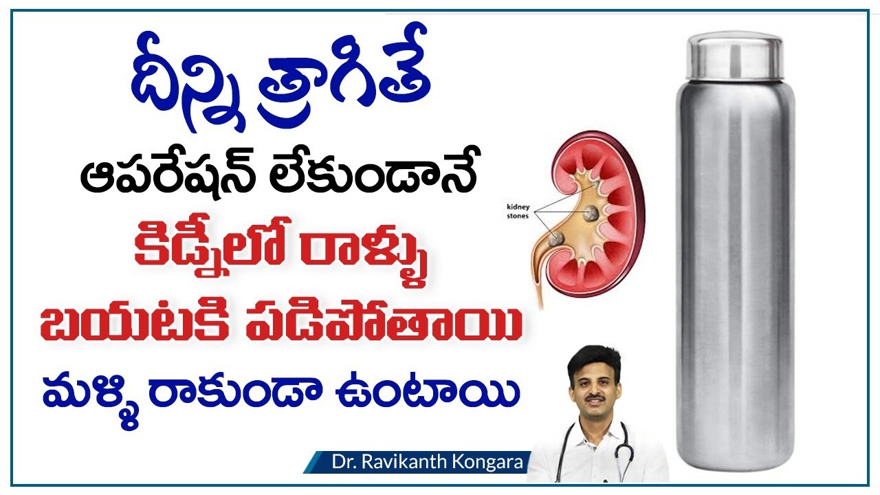 Kidney Stones VS Gallbladder Stones | How to Reduce Kidney Stones | Dr. Ravikanth Kongara