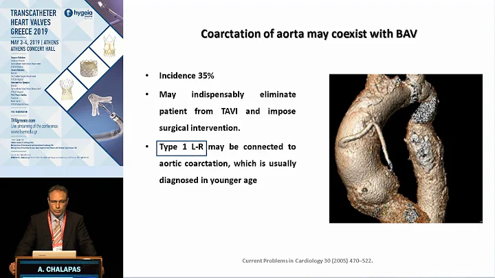 A. Chalapas | CT Imaging of Bicuspid Aortic Valve Disease.