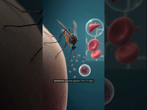 Malaria: Causes, Symptoms