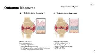 Derue Exercise & Pain