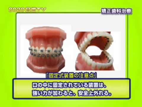 8020日歯TV　矯正歯科＜５＞矯正歯科治療の種類と内容