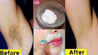 😱INCREDIBLE! How to get rid of facial hair, remove ingrown hairs forever!