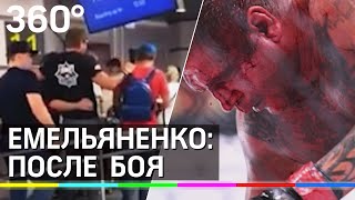 Емельяненко не может ходить после боя с Исмаиловым: видео