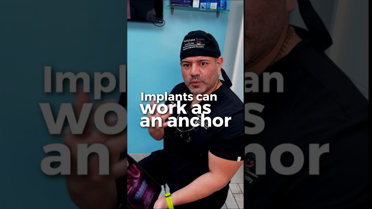 😁🦷Implants for secure dentures! 