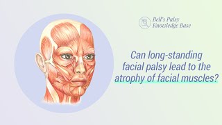 Can long-standing facial palsy lead to the atrophy of facial muscles? - Bell&#39;s Palsy Video Lectures