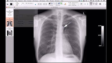 How to create anatomy teaching sets using OsiriX