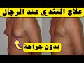 علاج التثدي عند الرجال بدون جراحة 