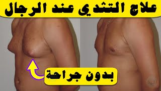 علاج التثدي عند الرجال بدون جراحة