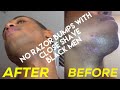 How to shave and not get razor bumps while black