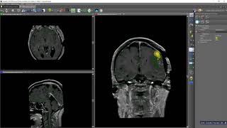 Manual slice by slice segmentation