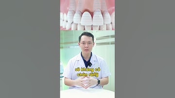 Mất răng cửa phải làm sao? #trongrangimplant #nhakhoa #vietsmile #shorts