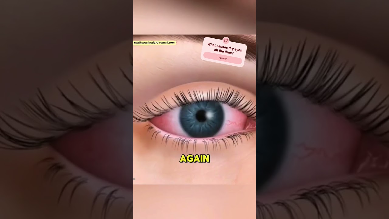 Dry Eyes 👀 ✨🙌also known as dry eye syndrome or keratoconjunctivitis sicca Explain in 3D Animation🙂🗣️