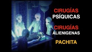 PACHITA: CIRUGIAS ALIENIGENAS