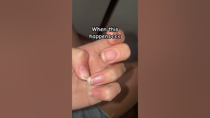 This is the worst #nail #nailpolish #nailart #nightmare #nailgrowth #girls #onlygirlswillunderstand