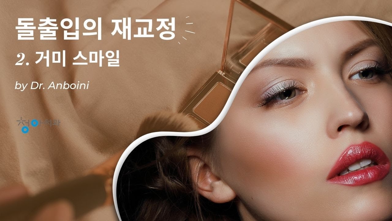 돌출입의 재교정 2 - 거미 스마일 -