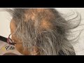 Short quick weave | Gray hair weave | Alopecia regrowth