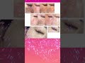 【おうちでシミを消す方法】シミ消し成功から1年後の無加工肌を大公開！【美容のプロが実証しました】