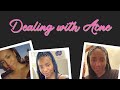 Dealing With Acne | Insecurity + A Little Karaoke Fun