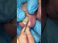Satisfying Pedicure Routine | Gentle Toenail Care #fypシ #fypシ #pedicure #nailcare