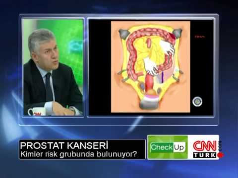 Prostat Kanserinden Korunmak Mümkün Müdür?