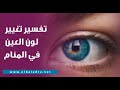 تفسير تغيير لون العين في المنام 