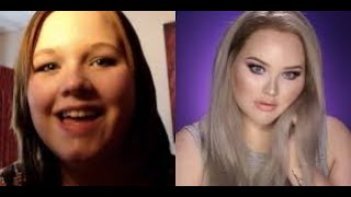 NikkieTutorials | Before and After Transformations | Her Cosmetic Surgery and More