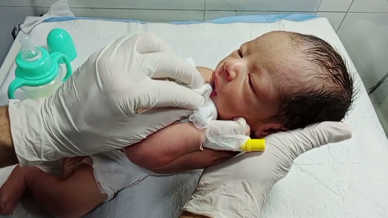 TTN Newborn Baby in NICU | Treatment Care Management & Starting Feeding Trial in Good Condition