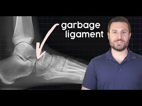 This is why you always sprain your ankle | Corporis