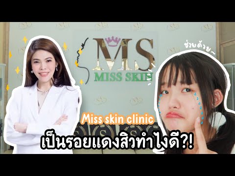 wendyพาไป#11 คอสเพลย์แล้วสิวขึ้นทำไงดี!? - Miss skin clinic by หมอปอ //wendytube channel