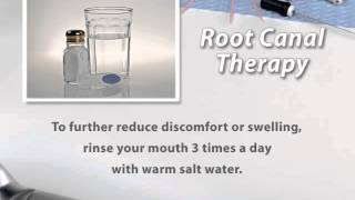 Root Canal: Post Op Instructions
