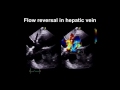 Echocardiography Essentials: Spotting tricuspid and pulmonary valve disease