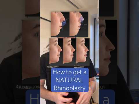Video thumbnail: Look unrecognizable with an unrecognizable surgery 👀🤩 · Albert Plastic Surgery New York
