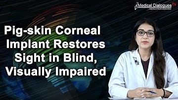 Pig Skin Corneal Implant Restores Sight in Blind, Visually Impaired