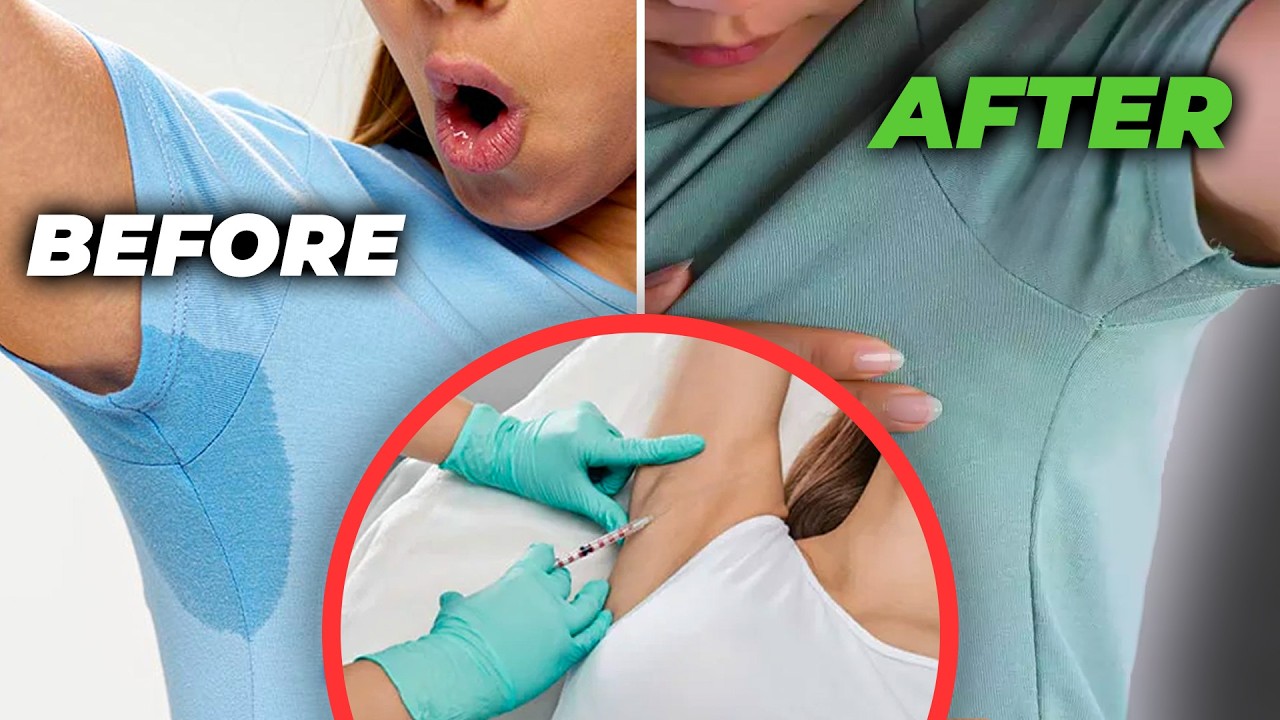 Sweaty armpits? Try botox!