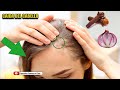 Remedio Casero para Tratar la calvicie  Y la caída del cabello