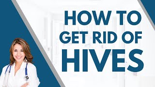 How to get rid of hives I Dermatologist Guide