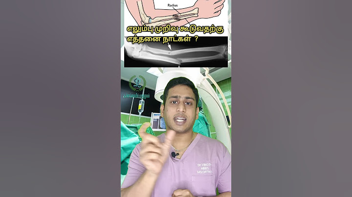 எலும்பு முறிவு கூடுவதற்கு எவ்வளவு நாட்கள் தேவை | Fracture healing duration #fracture #bonehealing