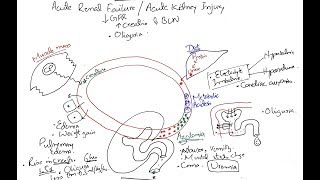 Understanding Acute Renal Failure (Acute Kidney Injury) - Simple Explanation