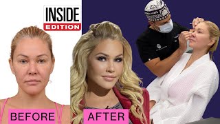 Inside Edition With Shanna Moakler Dr Ben Talei Beverly Hills Facial Plastic Surgeon