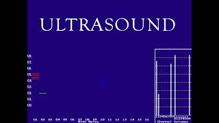 Gravis UltraSound (GUS 411) MIDI DEMO