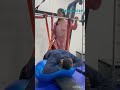 spinal cord injury patients closer to strength, stability, and independent movement. Dehradun #sci