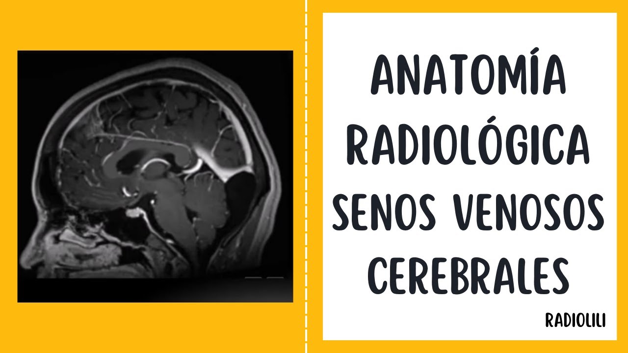 anatomía radiológica senos venosos cerebrales youtube