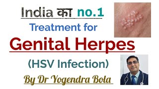 Genital Herpes Hsv Infection - Ka Complete 100 % Treatment