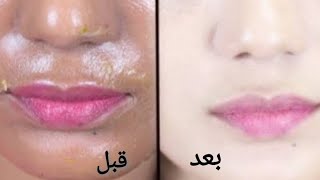 اسرع ماسك لتفتيح وترطيب البشره ???