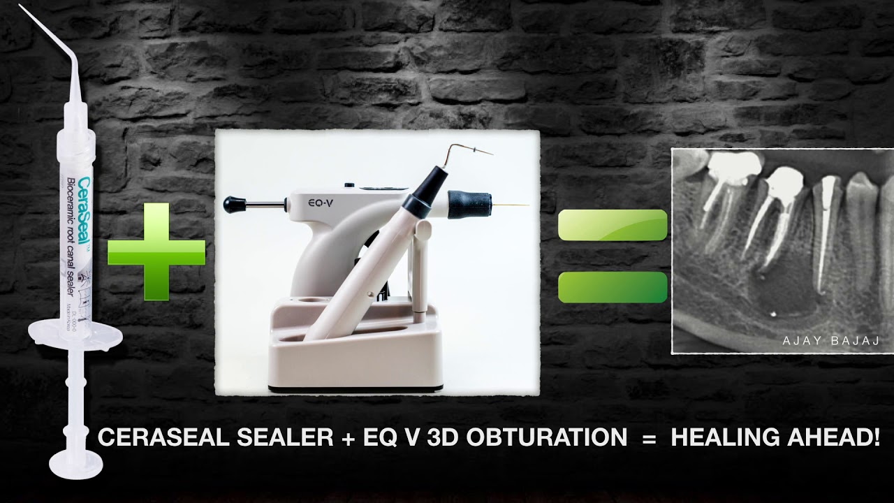 PERIAPICAL LESION HEALING INVOLVING MANDIBULAR NERVE
