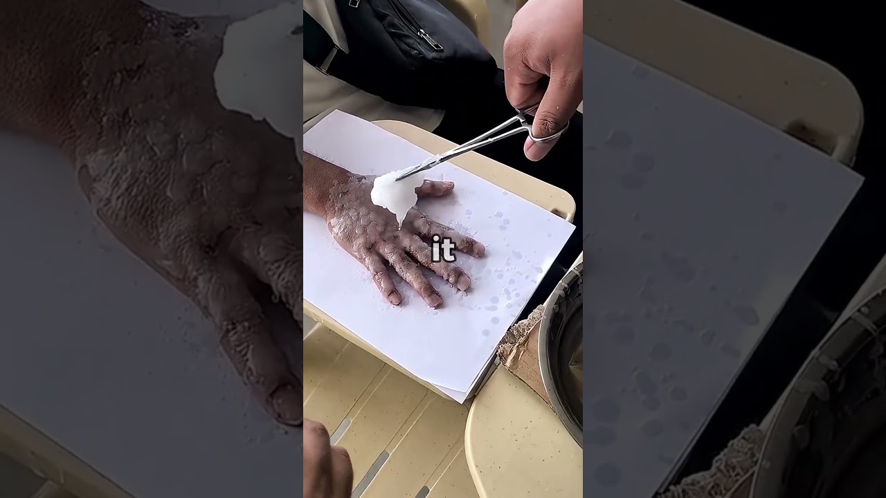 This Weird Test Catches Suspects?!