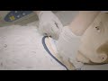 Changing a Tracheostomy Tube